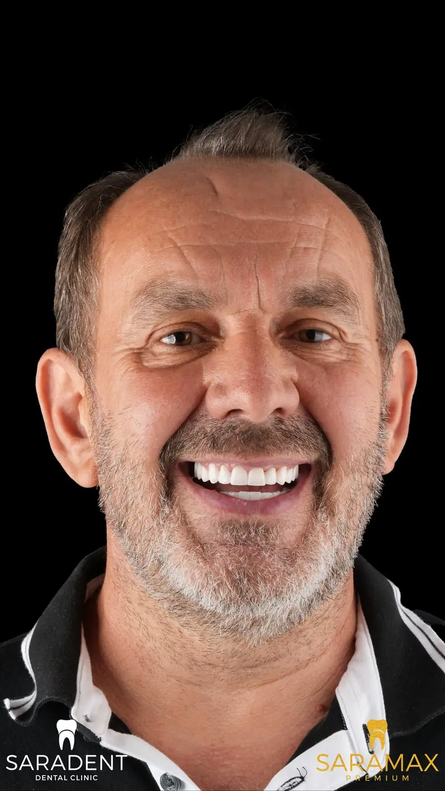 Older man with a grey beard and a new smile