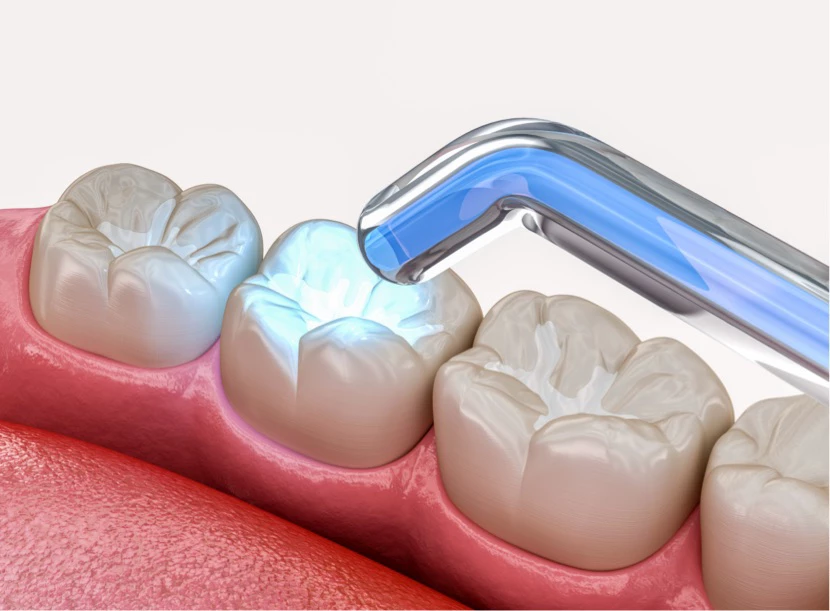 Opšta Stomatologija u Sarajevu - Saradent